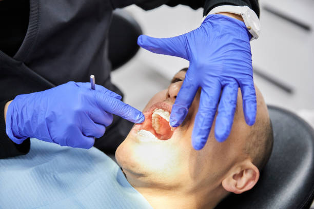 Best Emergency Dental Care for Broken or Chipped Teeth in Newton, NC